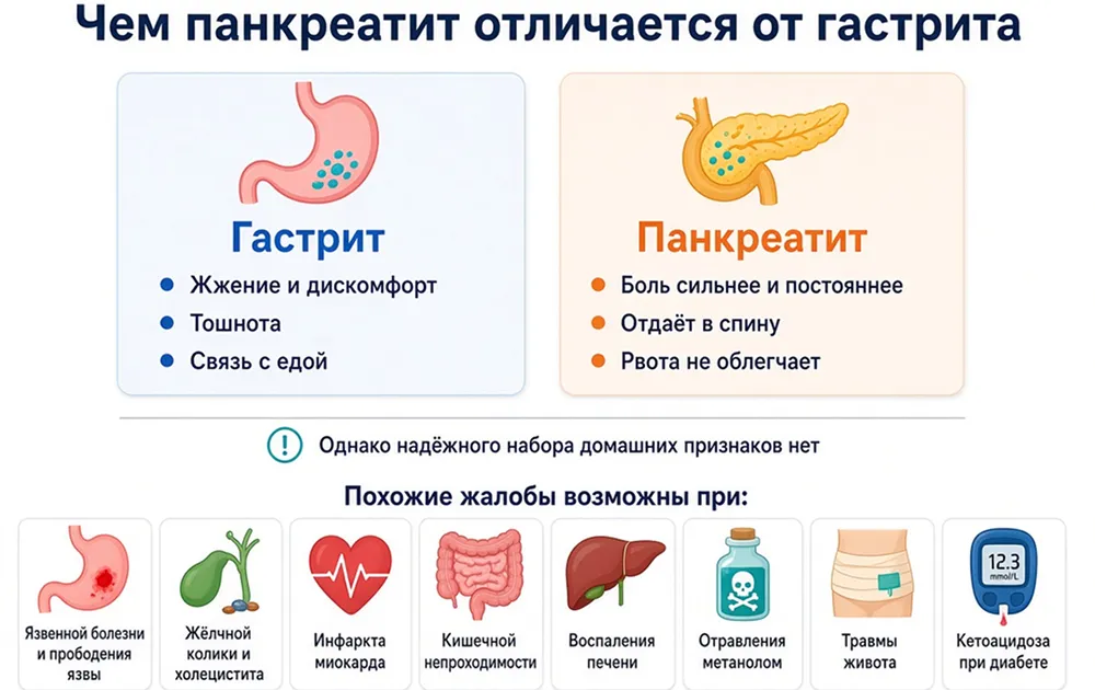 Инфографика о том, чем панкреатит отличается от гастрита